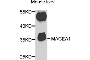 Western blot analysis of extracts of mouse liver, using MAGEA1 antibody (ABIN5973183) at 1/1000 dilution. (MAGEA1 Antikörper)