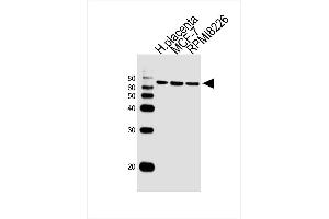 Lane 1: Sample Tissue/Cell lysates, Lane 2: Sample Tissue/Cell lysates, Lane 3: Sample Tissue/Cell lysates, probed with antibodyname Monoclonal Antibody, unconjugated (bsm-51388M) at 1:1000 overnight at 4°C followed by a conjugated secondary antibody for 60 minutes at 37°C. (RPS6KB2 Antikörper)