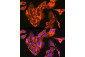 Immunofluorescence analysis of U-2 OS cells using JNK1/JNK3 Rabbit mAb (ABIN1678909, ABIN7101754, ABIN7101755 and ABIN7101756) at dilution of 1:100 (40x lens). (JNK Antikörper)
