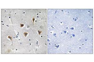 Immunohistochemistry (IHC) image for anti-Mitochondrial Transcription Termination Factor (MTERF) (Internal Region) antibody (ABIN1852304) (MTERF Antikörper  (Internal Region))
