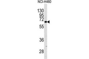Western Blotting (WB) image for anti-Keratin 9 (KRT9) antibody (ABIN3003129) (KRT9 Antikörper)