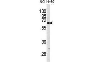 Western Blotting (WB) image for anti-Keratin 9 (KRT9) antibody (ABIN5023183) (KRT9 Antikörper)