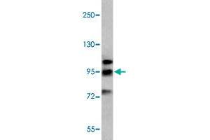 Western blot analysis of K-562 cell lysate (35 ug/lane) with GRM6 polyclonal antibody . (Metabotropic Glutamate Receptor 6 Antikörper  (C-Term))
