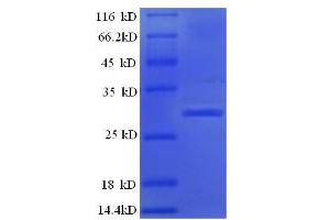 SDS-PAGE (SDS) image for Kallikrein B, Plasma (Fletcher Factor) 1 (KLKB1) (AA 391-638), (Light Chain) protein (His tag) (ABIN5713586)