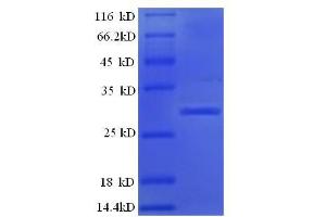 SDS-PAGE (SDS) image for Kallikrein B, Plasma (Fletcher Factor) 1 (KLKB1) (AA 391-638), (Light Chain) protein (His tag) (ABIN5713586)