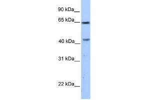 WB Suggested Anti-CCDC60 Antibody Titration: 0. (CCDC60 Antikörper  (C-Term))