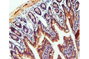 IHC analysis of TDRD3 using anti-TDRD3 antibody (ABIN6719636). (TDRD3 Antikörper)