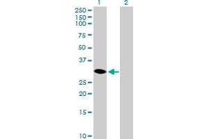 Western Blot analysis of HSD17B14 expression in transfected 293T cell line by HSD17B14 MaxPab polyclonal antibody. (HSD17B14 Antikörper  (AA 1-270))