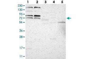 Western blot analysis of Lane 1: RT-4, Lane 2: U-251 MG, Lane 3: Human Plasma, Lane 4: Liver, Lane 5: Tonsil with ZNF90 polyclonal antibody .