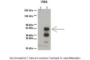 Sample Type :  1: 20ug HEK293T no transfection, 2: 20ug HEK293T 3Flag-MAVS/VISA  Primary Antibody Dilution :  1:1000  Secondary Antibody :  Anti-rabbit HRP  Secondary Antibody Dilution :  1:1000  Color/Signal Descriptions :  ARP49558-QC17479-WB-image-02  Gene Name :  VISA  Submitted by :  Dr. (MAVS Antikörper  (N-Term))