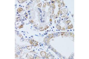 Immunohistochemistry of paraffin-embedded human stomach using DNAJC19 antibody (ABIN1876363) at dilution of 1:100 (40x lens).