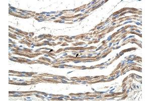 Pannexin 2 antibody was used for immunohistochemistry at a concentration of 4-8 ug/ml to stain Skeletal muscle cells (arrows) in Human Muscle. (Pannexin 2 Antikörper  (N-Term))