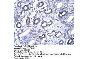 Human kidney (FOXP1 Antikörper  (N-Term))
