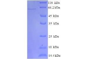 SDS-PAGE (SDS) image for Indoleamine 2,3-Dioxygenase 2 (IDO2) (AA 1-407), (full length) protein (His-SUMO Tag) (ABIN5709705) (IDO2 Protein (AA 1-407, full length) (His-SUMO Tag))