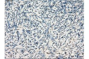 Immunohistochemical staining of paraffin-embedded colon tissue using anti-LTA4Hmouse monoclonal antibody. (LTA4H Antikörper)
