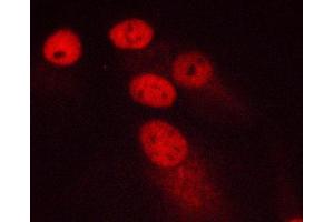 ABIN6266578 staining MCF-7 cells by ICC/IF. (Ki-67 Antikörper  (Internal Region))