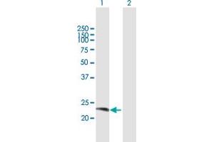 Western Blot analysis of RAB38 expression in transfected 293T cell line by RAB38 MaxPab polyclonal antibody. (RAB38 Antikörper  (AA 1-211))