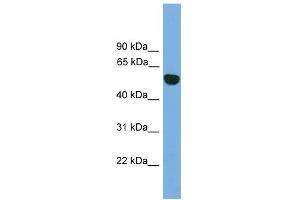 WB Suggested Anti-EPHX1 Antibody Titration: 0. (EPHX1 Antikörper  (N-Term))