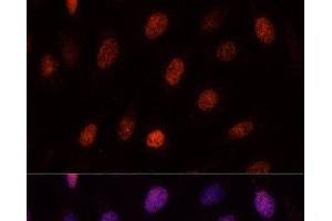 Immunofluorescence analysis of U-2OS cells using PCGF1 Polyclonal Antibody at dilution of 1:100. (PCGF1 Antikörper)