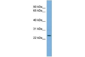 WB Suggested Anti-THAP6 Antibody Titration: 0. (THAP6 Antikörper  (Middle Region))
