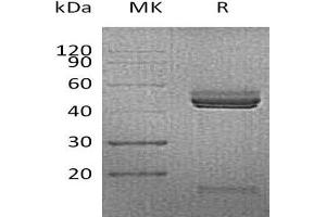 Western Blotting (WB) image for Interleukin 23 (IL23) protein (His tag) (ABIN7320812) (IL23 Protein (His tag))