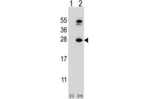 Western blot analysis of DHFR antibody and 293 cell lysate either nontransfected (Lane 1) or transiently transfected (2) with the DHFR gene.