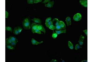 Immunofluorescent analysis of MCF-7 cells using ABIN7155869 at dilution of 1:100 and Alexa Fluor 488-congugated AffiniPure Goat Anti-Rabbit IgG(H+L) (HIPK3 Antikörper  (AA 841-1130))