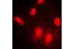 Immunofluorescent analysis of IPPK staining in NIH3T3 cells. (IPPK Antikörper  (N-Term))