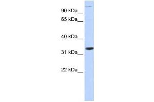 Western Blotting (WB) image for anti-Acidic (Leucine-Rich) Nuclear phosphoprotein 32 Family, Member B (ANP32B) antibody (ABIN2459518) (ANP32B Antikörper)