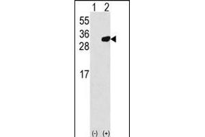 Western blot analysis of PRDX6 (arrow) using rabbit polyclonal PRDX6 Antibody (C-term) (R).