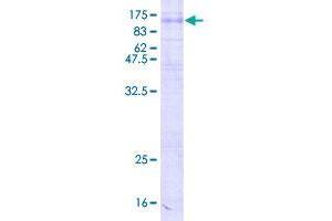 Synaptic Vesicle Glycoprotein 2C (SV2C) (AA 1-727) protein (GST tag)