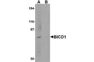 Western blot analysis of BICD1 in Daudi cell lysate with AP30144PU-N BICD1 antibody at 1 μg/ml in (A) the absence and (B) the presence of blocking peptide. (BICD1 Antikörper  (C-Term))
