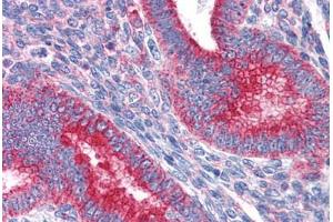 Human Uterus: Formalin-Fixed, Paraffin-Embedded (FFPE) (MVP Antikörper  (AA 1-894))