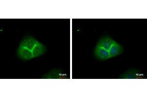 ICC/IF Image alpha Adducin antibody detects alpha Adducin protein at membrane by immunofluorescent analysis. (alpha Adducin Antikörper)