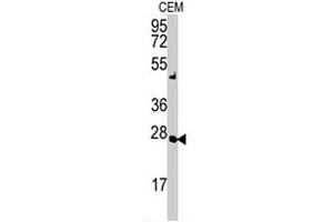 Western blot analysis of AK2 polyclonal antibody  in CEM cell lysate (35 ug/lane). (Adenylate Kinase 2 Antikörper  (N-Term))