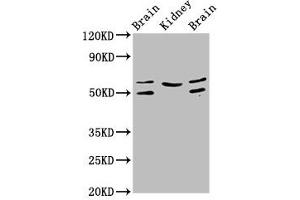 Western Blot Positive WB detected in: Rat brain tissue, Rat kidney tissue, Mouse brain tissue All lanes: ANGPT2 antibody at 3.