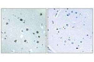 Immunohistochemistry analysis of paraffin-embedded human brain tissue using MYO1D antibody. (Myosin ID Antikörper)