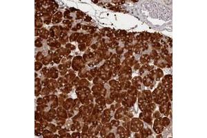 Immunohistochemical staining of human pancreas with HARBI1 polyclonal antibody  shows strong cytoplasmic positivity in exocrine glandular cells at 1:500-1:1000 dilution. (HARBI1 Antikörper)