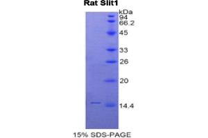 SDS-PAGE analysis of Rat Slit Homolog 1 Protein. (SLIT1 Protein)