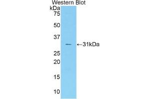Western blot analysis of the recombinant protein. (Coagulation Factor V Antikörper  (AA 1776-2028))