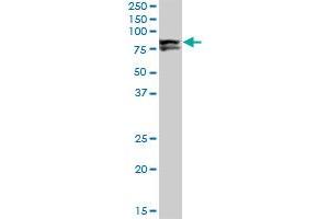 LIMK1 monoclonal antibody (M01), clone 1A8. (LIM Domain Kinase 1 Antikörper  (AA 548-647))