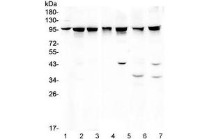 Western blot testing of 1) rat testis, 2) mouse testis, 3) human A375 and 4) human HeLa lysate wtih ALIX antibody. (ALIX Antikörper  (AA 2-330))