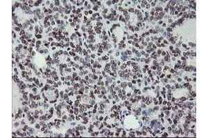 Image no. 1 for anti-Myeloid Leukemia Factor 1 (MLF1) antibody (ABIN1499493)