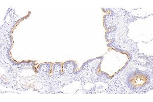 Detection of RALBP1 in Human Lung Tissue using Polyclonal Antibody to RalA Binding Protein 1 (RALBP1) (RALBP1 Antikörper  (AA 403-499))