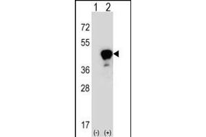 Western blot analysis of LRG1 (arrow) using rabbit polyclonal LRG1 Antibody (Center) (ABIN390660 and ABIN2840956). (LRG1 Antikörper  (AA 194-223))