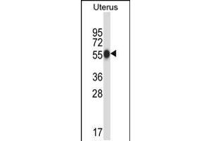 Western blot analysis in human normal Uterus tissue lysates (35ug/lane). (CPO Antikörper  (N-Term))