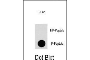 Dot blot analysis of anti-EGFR-p Phospho-specific Pab (ABIN1881285 and ABIN2850456) on nitrocellulose membrane. (EGFR Antikörper  (pTyr1092))