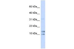 WB Suggested Anti-IL15 Antibody Titration: 0.