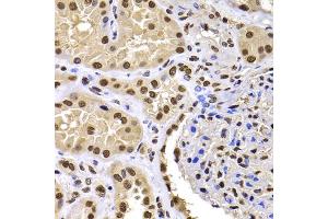 Immunohistochemistry of paraffin-embedded human kidney using HIRIP3 antibody (ABIN5974221) at dilution of 1/100 (40x lens). (HIRIP3 Antikörper)