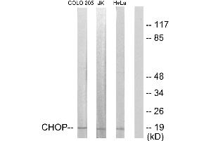 Immunohistochemistry analysis of paraffin-embedded human skeletal muscle tissue using CHOP (Ab-30) antibody. (DDIT3 Antikörper  (Ser30))